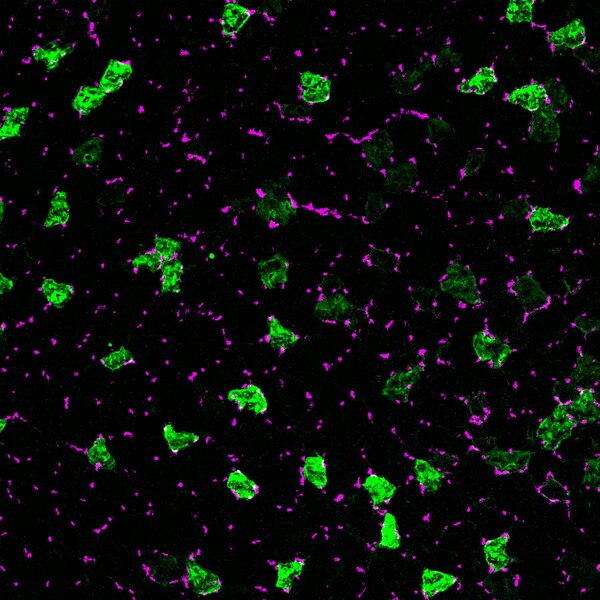 Immunofluorescent image of mouse muscle cryosections labeled with DSHB antibody 6H1-Xi/Rabbit against Myosin heavy chain, Type IIX (green). Image Credit: Yang-Nim Park, DSHB 